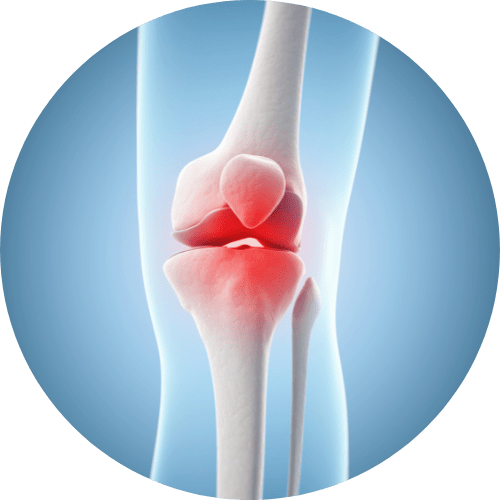 riabilitazione fisioterapia ginocchio sovizzo